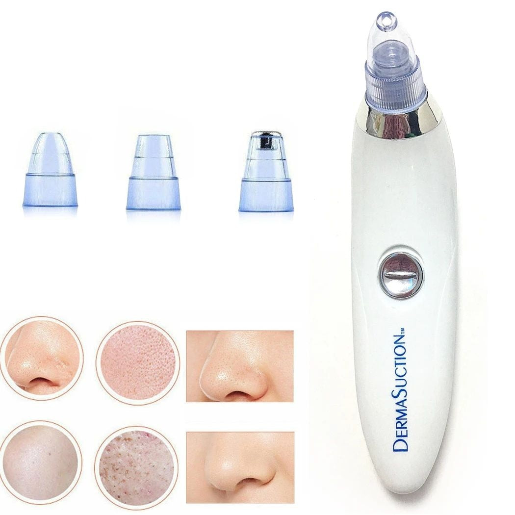 4-in-1 Blackhead Remover Vacuum – Portable Pore Cleaner & Facial Derma Suction Machine